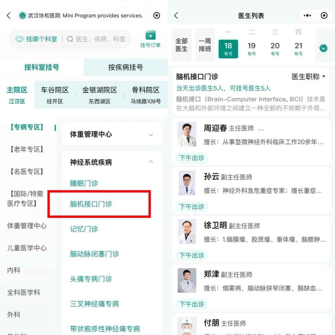 脑机接口门诊示意图