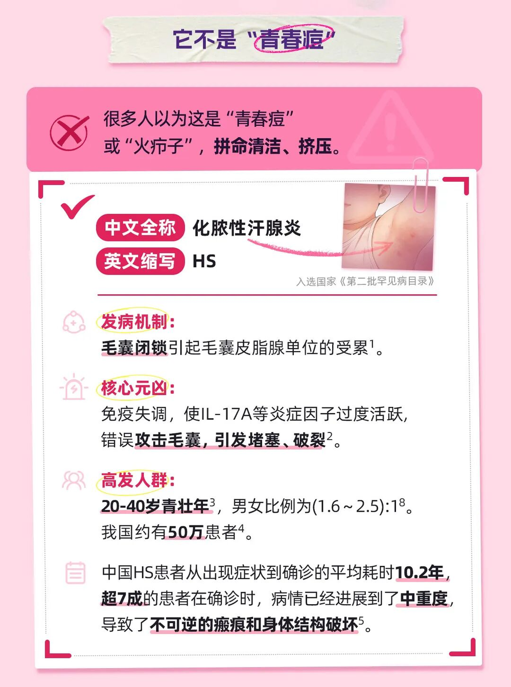 HS疾病百科
